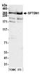 Spectrin Beta, Non-Erythrocytic 1 antibody, A300-936A, Bethyl Labs, Western Blot image 
