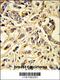 Fms Related Tyrosine Kinase 1 antibody, 63-888, ProSci, Immunohistochemistry paraffin image 