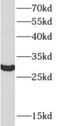 Toll Interacting Protein antibody, FNab08854, FineTest, Western Blot image 