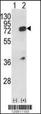 Heterogeneous Nuclear Ribonucleoprotein L antibody, 61-621, ProSci, Western Blot image 