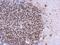 Casein Kinase 2 Alpha 1 antibody, NBP2-15909, Novus Biologicals, Immunohistochemistry paraffin image 