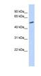 IKAROS Family Zinc Finger 2 antibody, NBP1-79703, Novus Biologicals, Western Blot image 