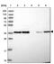 Heparin Binding Growth Factor antibody, PA5-61810, Invitrogen Antibodies, Western Blot image 