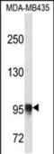 Procollagen-Lysine,2-Oxoglutarate 5-Dioxygenase 3 antibody, PA5-48435, Invitrogen Antibodies, Western Blot image 