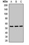 Inosine Monophosphate Dehydrogenase 1 antibody, LS-C667858, Lifespan Biosciences, Western Blot image 