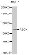 Reversion Inducing Cysteine Rich Protein With Kazal Motifs antibody, MBS125427, MyBioSource, Western Blot image 