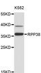 Ribonuclease P/MRP Subunit P38 antibody, STJ26672, St John
