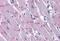 Pappalysin 2 antibody, MBS243427, MyBioSource, Immunohistochemistry paraffin image 