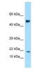 Ankyrin Repeat Domain 37 antibody, NBP1-98583, Novus Biologicals, Western Blot image 