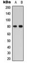 Parathyroid Hormone 1 Receptor antibody, orb304527, Biorbyt, Western Blot image 