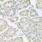 TNF Receptor Superfamily Member 10a antibody, LS-C334601, Lifespan Biosciences, Immunohistochemistry paraffin image 