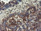 Ubiquitin Conjugating Enzyme E2 J1 antibody, LS-C787334, Lifespan Biosciences, Immunohistochemistry frozen image 