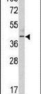 Thymine DNA Glycosylase antibody, PA5-13576, Invitrogen Antibodies, Western Blot image 