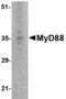 MYD88 Innate Immune Signal Transduction Adaptor antibody, M00025-2, Boster Biological Technology, Western Blot image 