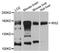 Insulin Receptor Substrate 2 antibody, A7945, ABclonal Technology, Western Blot image 