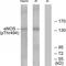 Nitric Oxide Synthase 3 antibody, TA314271, Origene, Western Blot image 