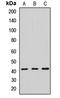 Septin 2 antibody, LS-C667933, Lifespan Biosciences, Western Blot image 