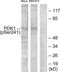 3-phosphoinositide-dependent protein kinase 1 antibody, LS-C117457, Lifespan Biosciences, Western Blot image 