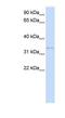 Decorin antibody, NBP1-57923, Novus Biologicals, Enzyme Linked Immunosorbent Assay image 