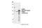 Proteasome 26S Subunit, Non-ATPase 2 antibody, 25430S, Cell Signaling Technology, Western Blot image 