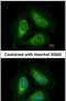 Phosphatidylinositol-5-Phosphate 4-Kinase Type 2 Alpha antibody, PA5-28435, Invitrogen Antibodies, Immunofluorescence image 