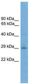 Transmembrane Protein 139 antibody, TA337842, Origene, Western Blot image 