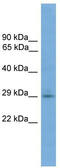 Transmembrane Protein 139 antibody, TA337842, Origene, Western Blot image 