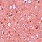 SEC14 And Spectrin Domain Containing 1 antibody, orb75473, Biorbyt, Immunohistochemistry paraffin image 