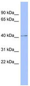 Protein Kinase CAMP-Dependent Type I Regulatory Subunit Beta antibody, TA337697, Origene, Western Blot image 