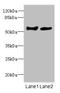 COCH antibody, LS-C675557, Lifespan Biosciences, Western Blot image 
