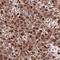 AE Binding Protein 1 antibody, NBP2-49432, Novus Biologicals, Immunohistochemistry frozen image 