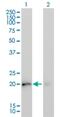 KRAS Proto-Oncogene, GTPase antibody, H00003845-M02, Novus Biologicals, Western Blot image 