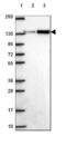 Structural Maintenance Of Chromosomes 2 antibody, NBP2-49655, Novus Biologicals, Western Blot image 