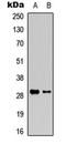 Granzyme K antibody, LS-C368594, Lifespan Biosciences, Western Blot image 