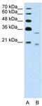 Deoxyribonuclease-2-beta antibody, TA329459, Origene, Western Blot image 