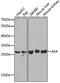 Adenylate Kinase 4 antibody, GTX30038, GeneTex, Western Blot image 