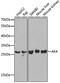 Adenylate kinase isoenzyme 4, mitochondrial antibody, GTX30038, GeneTex, Western Blot image 