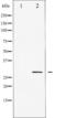 Cyclin Dependent Kinase Inhibitor 1B antibody, TA325353, Origene, Western Blot image 
