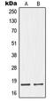 Neuromedin S antibody, LS-C353627, Lifespan Biosciences, Western Blot image 