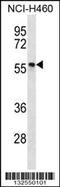 Phosphorylated Adaptor For RNA Export antibody, 56-680, ProSci, Western Blot image 