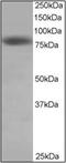 NDC80 Kinetochore Complex Component antibody, AP22482PU-N, Origene, Western Blot image 