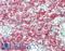 Keratin 5 antibody, LS-B12196, Lifespan Biosciences, Immunohistochemistry paraffin image 