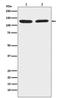 Chromogranin B antibody, M04073, Boster Biological Technology, Western Blot image 