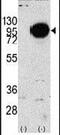 Glycogen Phosphorylase, Muscle Associated antibody, PA5-11511, Invitrogen Antibodies, Western Blot image 