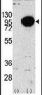 Glycogen Phosphorylase, Muscle Associated antibody, PA5-11511, Invitrogen Antibodies, Western Blot image 