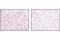 RUNX Family Transcription Factor 1 antibody, 4336T, Cell Signaling Technology, Immunohistochemistry paraffin image 