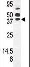 Pantothenate kinase 1 antibody, PA5-13960, Invitrogen Antibodies, Western Blot image 