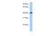 Coiled-Coil And C2 Domain Containing 1B antibody, GTX45782, GeneTex, Western Blot image 