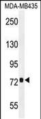 Coiled-Coil Domain Containing 81 antibody, PA5-48210, Invitrogen Antibodies, Western Blot image 