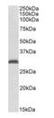 N-Acetyltransferase 1 antibody, orb154571, Biorbyt, Western Blot image 